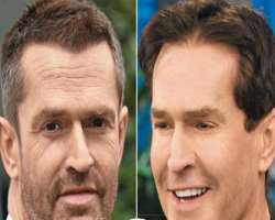 Kevin Kline before surgery
